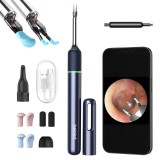 Bebird Note5 Otoscopio per pulizia auricolare con fotocamera 1080p Blu