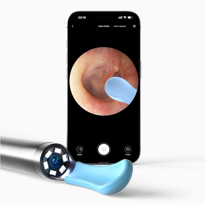 Bebird EarSight R1 Otoscopio con fotocamera 180 mAh Bianco