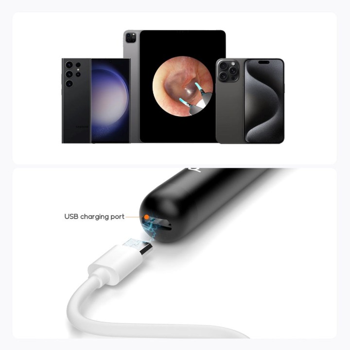 Bebird EarSight R1 Otoscopio con fotocamera 180 mAh Bianco